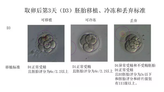 取卵后第3天丢弃胚胎的标准